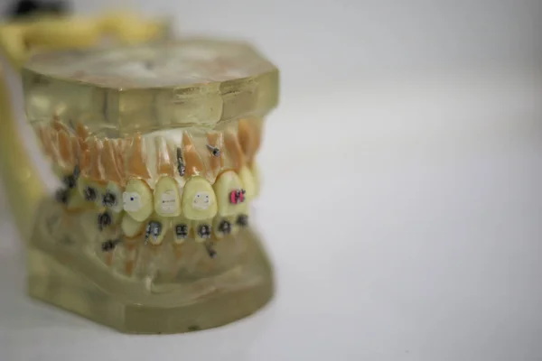 Οδοντιατρικά Εργαλεία Οδοντιατρική Υγιεινή Και Υγειονομική Περίθαλψη Έννοια — Φωτογραφία Αρχείου