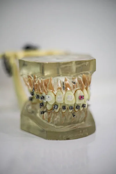 牙医的工具 口腔卫生和保健概念 — 图库照片#
