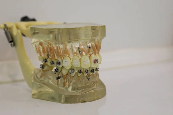 歯医者ツール 歯科衛生 医療コンセプト — ストック写真