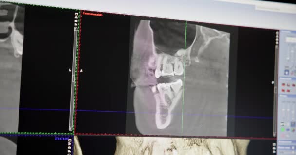 Σύγχρονη Έννοια Οδοντιατρική Γιατρός Οδοντίατρος Εξετάζει Την Οθόνη Μοντέλο Των — Αρχείο Βίντεο