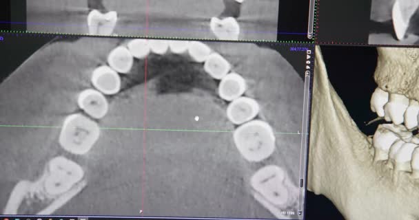 Conceito Odontologia Moderna Médico Dentista Olha Para Monitor Com Modelo — Vídeo de Stock