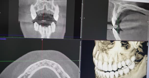 Moderní Zubní Koncept Lékař Zubní Lékař Podívá Monitor Modelem Rentgenových — Stock video