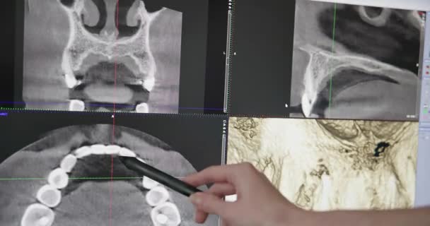 Σύγχρονη Έννοια Οδοντιατρική Γιατρός Οδοντίατρος Εξετάζει Την Οθόνη Μοντέλο Των — Αρχείο Βίντεο