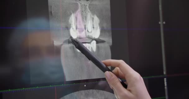 Modern Tandvård Koncept Läkare Tandläkare Tittar Bildskärm Med Modell Röntgen — Stockvideo