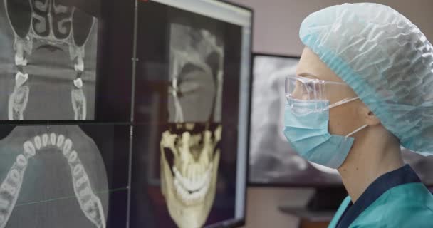 Radiologist Dentist Using Ray Software Desktop Computer — Stock Video