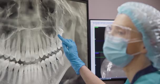 放射科牙医在台式计算机上使用X射线软件 — 图库视频影像