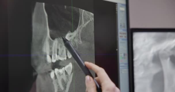 Radiolog Tandläkare Med Hjälp Ray Programvara Stationär Dator — Stockvideo