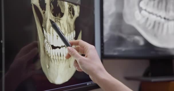 放射科牙医在台式计算机上使用X射线软件 — 图库视频影像