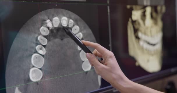 Dentista Radiologo Utilizzando Software Raggi Sul Computer Desktop — Video Stock