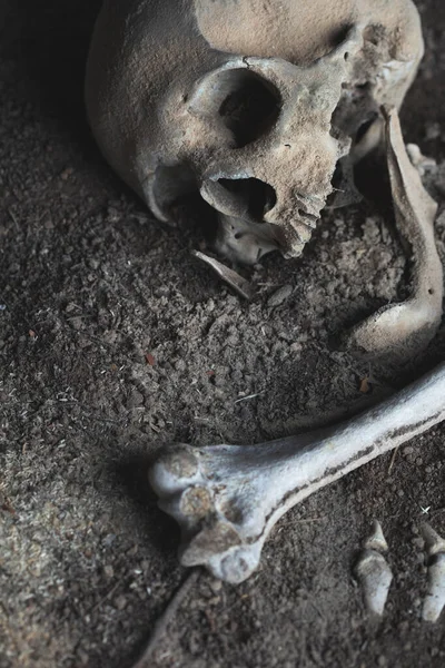 Czaszka Ludzkie Kości Zakopane Ziemi — Zdjęcie stockowe