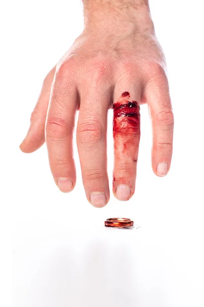 Mão Com Dedo Sangrento Anel Casamento Fundo Branco — Fotografia de Stock