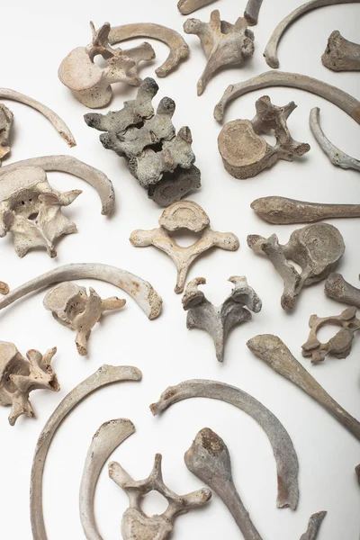 Knochen Menschliche Überreste Auf Weißem Hintergrund — Stockfoto