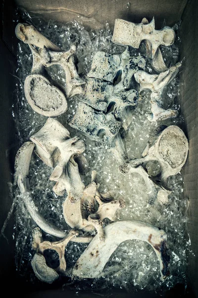 Emberi Csontcsigolyák Műanyag Csomagolású Kartondobozban — Stock Fotó