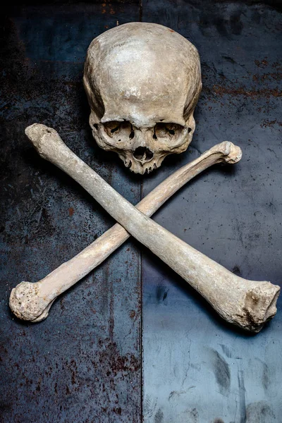頭蓋骨と太ももの骨を金属的な背景で — ストック写真