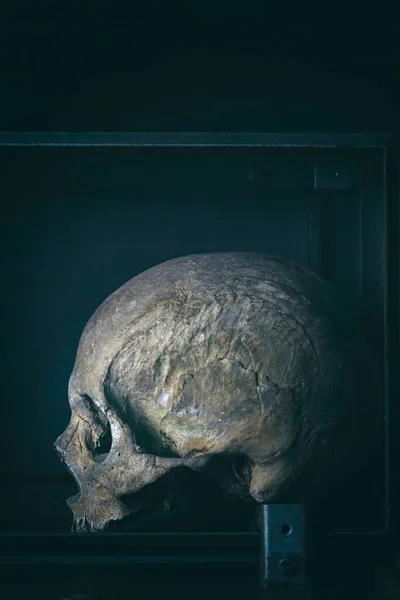 Crânio Humano Real Caixa Metal Fundo Escuro — Fotografia de Stock