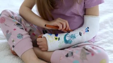 Adorable preschooler girl with a broken arm at home on the bed draws with felt-tip pens on an orthopedic cast. How to have fun with a broken limb. Broken arm in a cast in kids