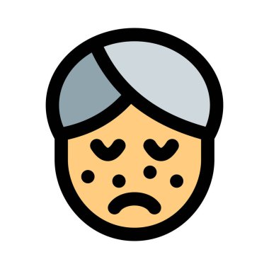 Yağlı cilt tipinde sivilceler.