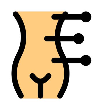 Kadın kaplıcalarda vücut akupunktur hizmeti sunuluyor