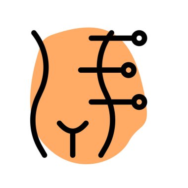 Kadın kaplıcalarda vücut akupunktur hizmeti sunuluyor