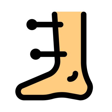 Düğümleri ve diğer sinir sorunlarını temizlemek için bacak akupunkturu