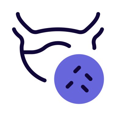 Safra kesesi enfeksiyonu, beyaz bir arka planda izole edilmiş bakteriyel enfeksiyon kapmış.