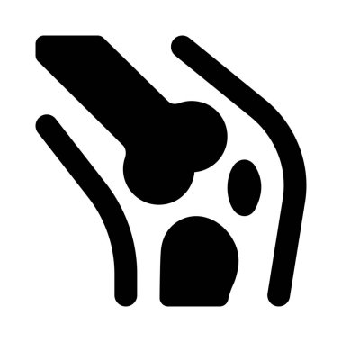 Dizinin arkasındaki ağrı küçük bir bacak krampı olabilir.