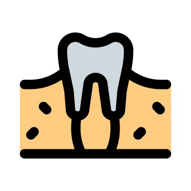 Bir diş, çenelerde kireçlenmiş bir yapı bulundu