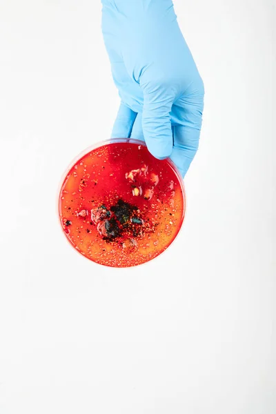 Hand in blue glove holding  petri dish with bacterium . Microbiology sience. Top  view.