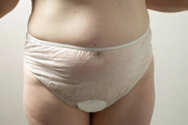 Female postpartum belly in disposable underpants, concept of postpartum recovery