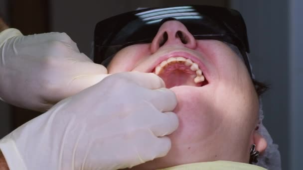 Chirurgien Buccal Vissant Dans Les Transferts Implant Dentaire Dans Bouche — Video