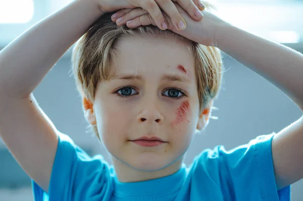 Porträt Eines Kindes Mit Kratzern Nach Sturz Gesicht — Stockfoto