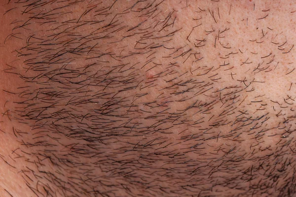 Human Male Beard Hair Close View — Stock Photo, Image