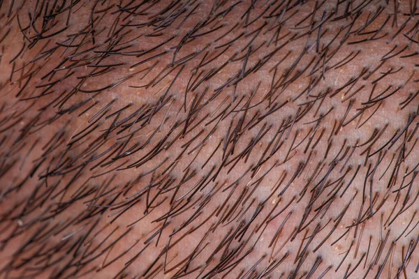 人間の男性のひげの毛の極度の閉鎖の眺め — ストック写真