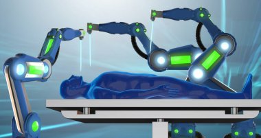 Robotik Kol tarafından gerçekleştirilen ameliyat