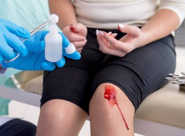 Leg injured woman visiting doctor clipart