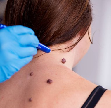 Doktor dermatoloğu ziyaret eden genç bir kadın.