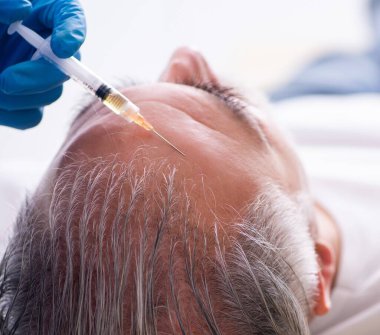 Yaşlı adam saç nakli konseptinde genç erkek doktoru ziyaret ediyor.