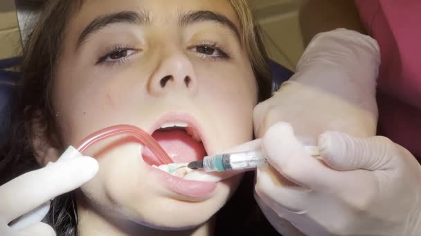 Kaukasisches Junges Mädchen Unterzieht Sich Einer Zahnreinigung Beim Zahnarzt — Stockvideo