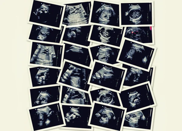 Collection Images Ultrasound Scan Examination Fetus 7Th Month — Stock Photo, Image
