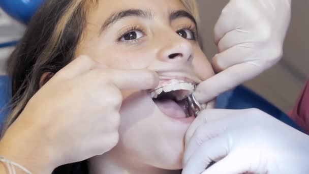 Caucásico Joven Chica Someterse Limpieza Dental Dentista — Vídeo de stock