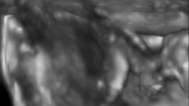 Three Dimensional Ultrasound Small Baby Weeks Weeks Pregnant Ultrasound Echography — 비디오