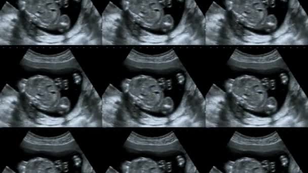 12週時のマルチスクリーン超音波小さな赤ちゃん 妊娠12週超音波画像は赤ちゃんや胎児の発達と妊娠の健康チェックを示しています — ストック動画