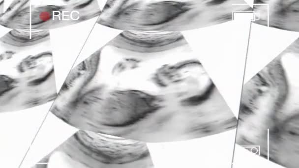 妊娠中の母親の子宮超音波を記録します 12週時の胎児の超音波 — ストック動画