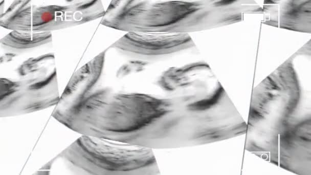 Aufnahme Eines Ultraschalls Der Gebärmutter Während Der Schwangerschaft Ultraschall Eines — Stockvideo