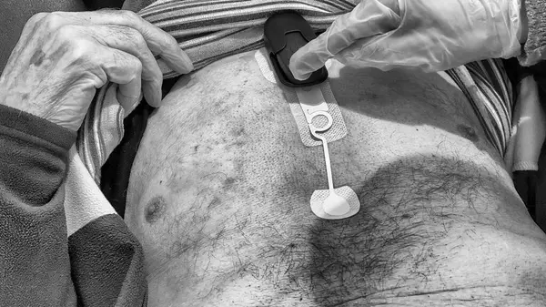 An elderly man in the hospital while having his Holter applied.