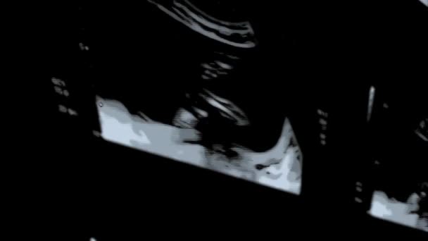 医学的参考と研究のための胎児超音波スクリーンの画像のコラージュ — ストック動画