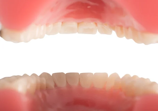 Uvnitř Úst Pacienta Zubním Lékařem — Stock fotografie