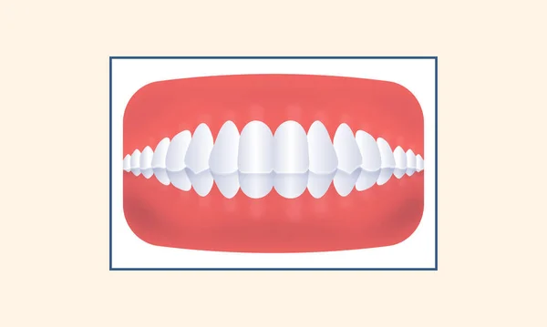 Crossbite Tänder Ikonen Mot Gul Bakgrund — Stock vektor