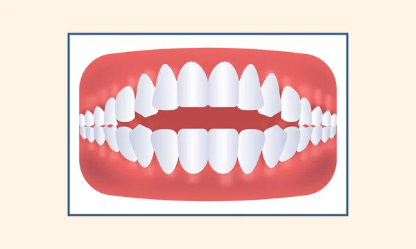Open Bite Teeth Icon Yellow Background — Stock Vector