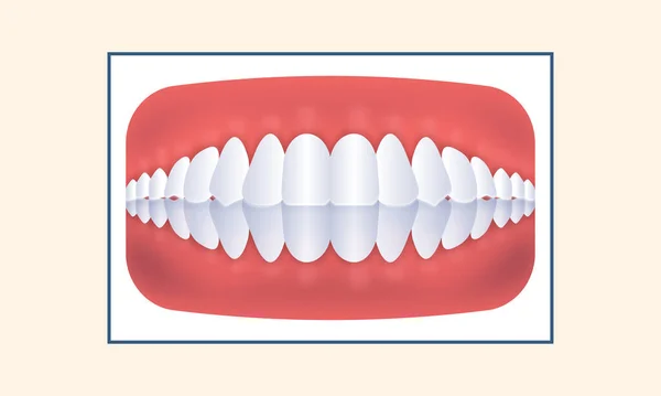 黄色い背景に人間の歯のアイコンをオーバーバイト — ストックベクタ